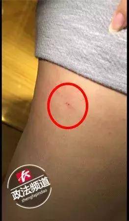 Letme一打二反殺，操作重回MSI巔峰，RNG夏季賽穩(wěn)了？